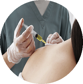 Manchas y alteraciones de la pigmentación