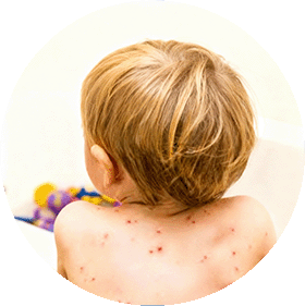 Infecciones cutáneas 