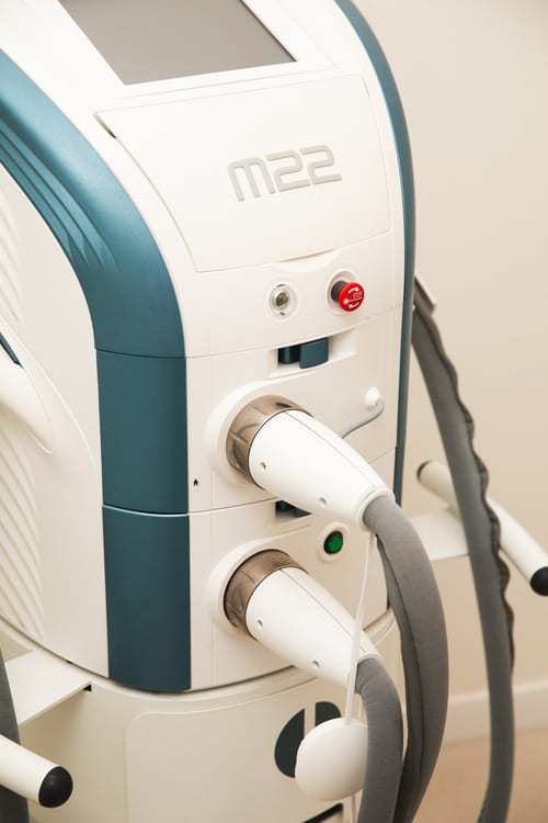 Láser para el acné y las rosáceas