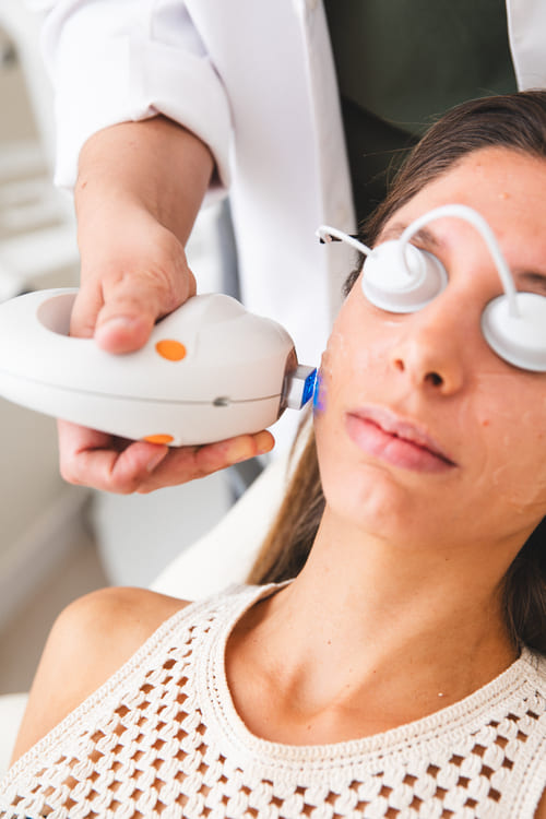 Láser para las estrías