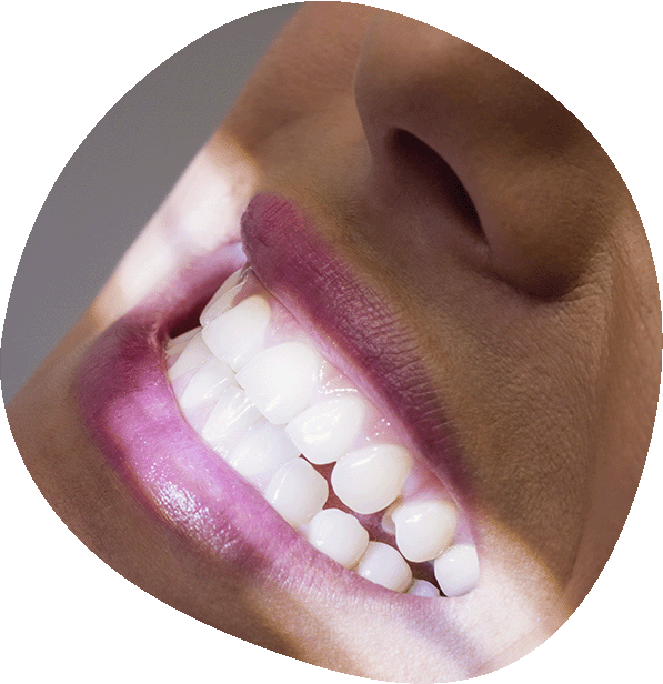 Tratamiento de Neuromoduladores en Luma Clinique, Alicante