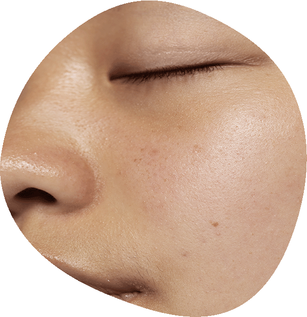 Diagnóstico con 520x en Luma Clinique, Alicante