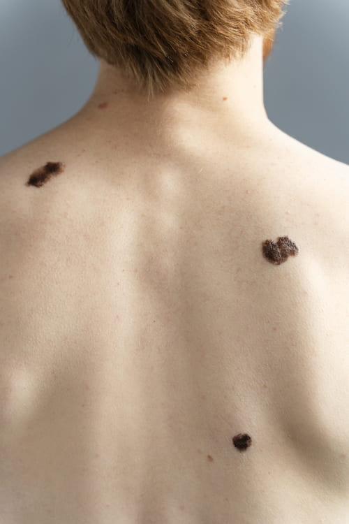 La importancia de un diágnostico preciso en Luma Clinique