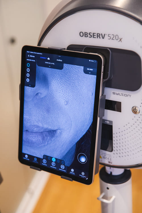 Por qué realizar un diagnóstico facial avanzado en Luma Clinique, Alicante