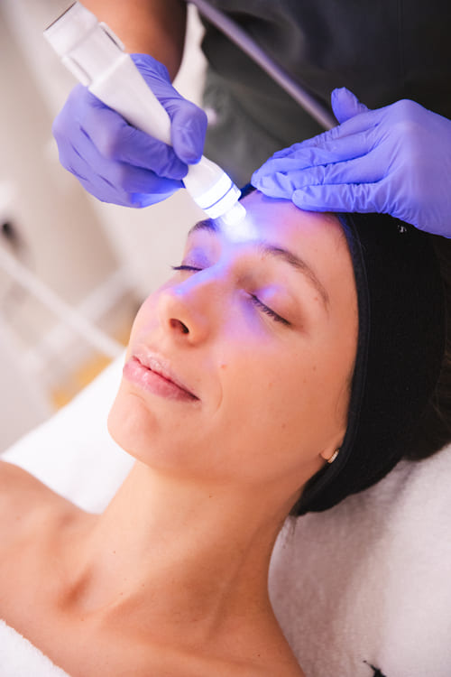 Preguntas frecuentes sobre el Aguapure en Alicante, Luma Clinique