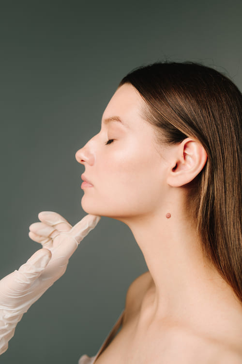 Preguntas de la riinomodelación en Luma Clinique, Alicante