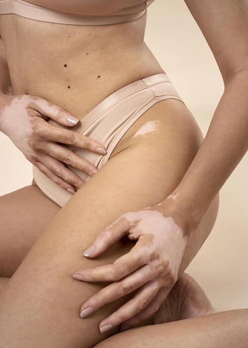 Preguntas frecuentes de mesoterapia corporal en Luma Clinique, Alicante