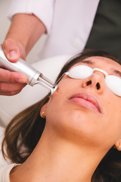 Preguntas frecuentes sobre Morpheus8 en Alicante, Luma Clinique