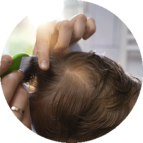 Problemas del cuero cabelludo