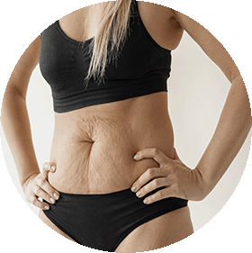 Reafirmación y tono cutáneo 