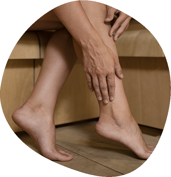 Tratamiento Varices en Luma Clinique, Alicante