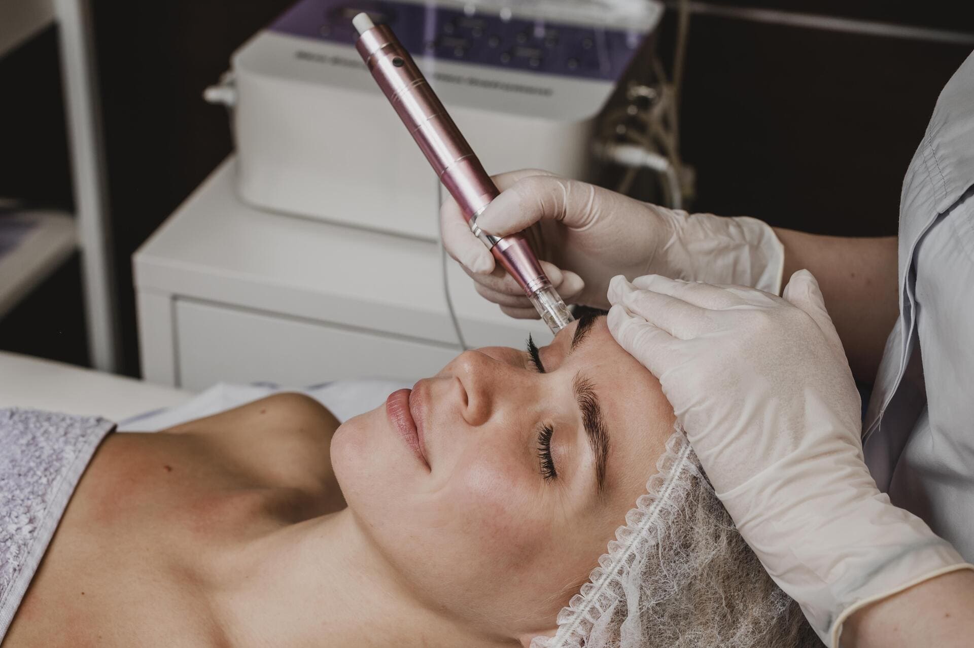 Ventajas del microneedling frente a otros tratamientos en Alicante, Luma Clinique