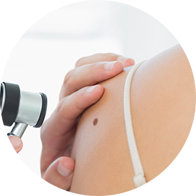 Psoriasis y dermatisis