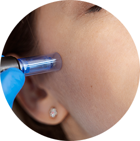 Dermatología venereológica (ETS)