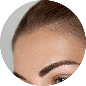 Eliminación de estrías y marcas